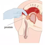 How to Squirt for Men: A Guide to Prostate Stimulation
