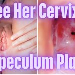 Cervix Closeup Using Speculum