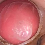 The camera in the deep pussy records a huge ejaculation of sperm into the condom Vidéos Porno