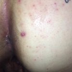 Pooping Cum after Anal