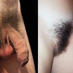Pubic hair