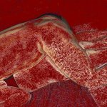Anal Prone Bone