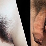 Pubic hair