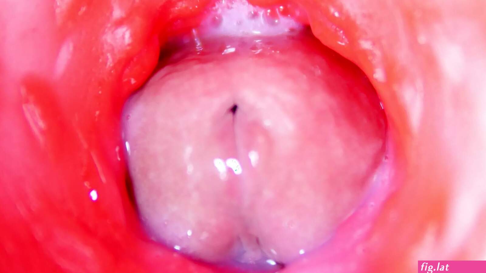 Anal camera inside (photos)