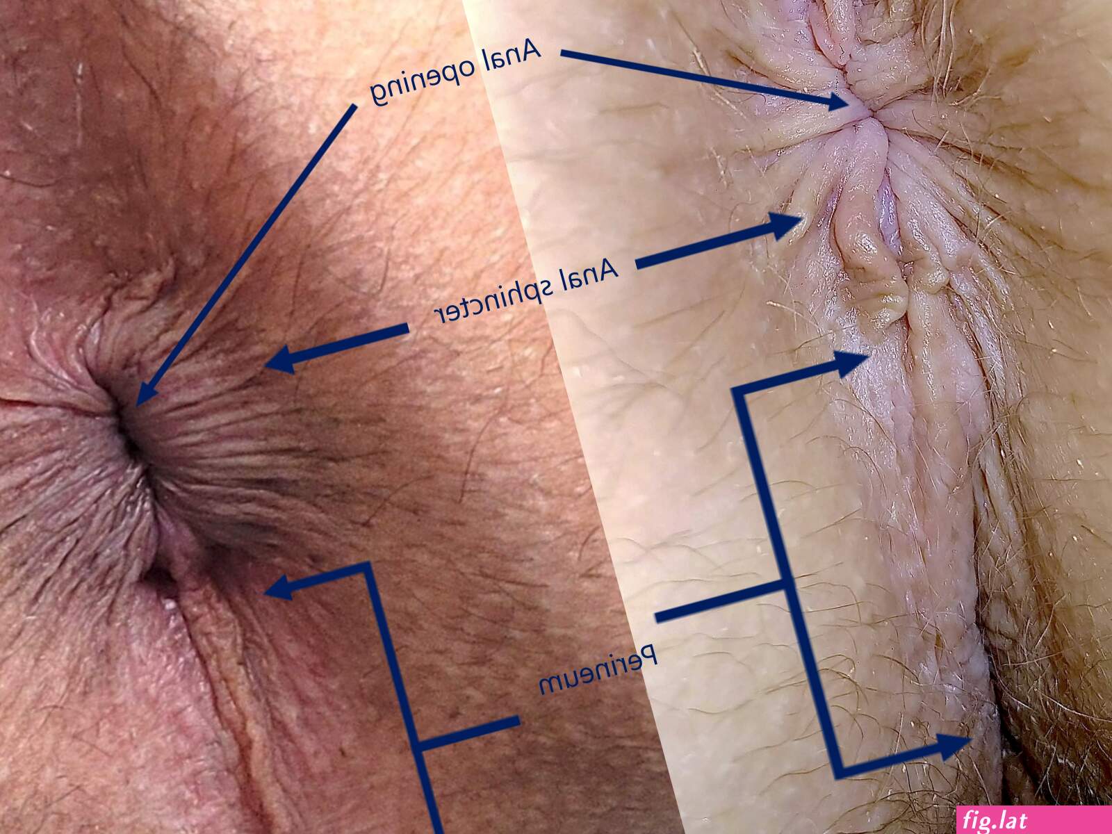 The upside of anal (photos)