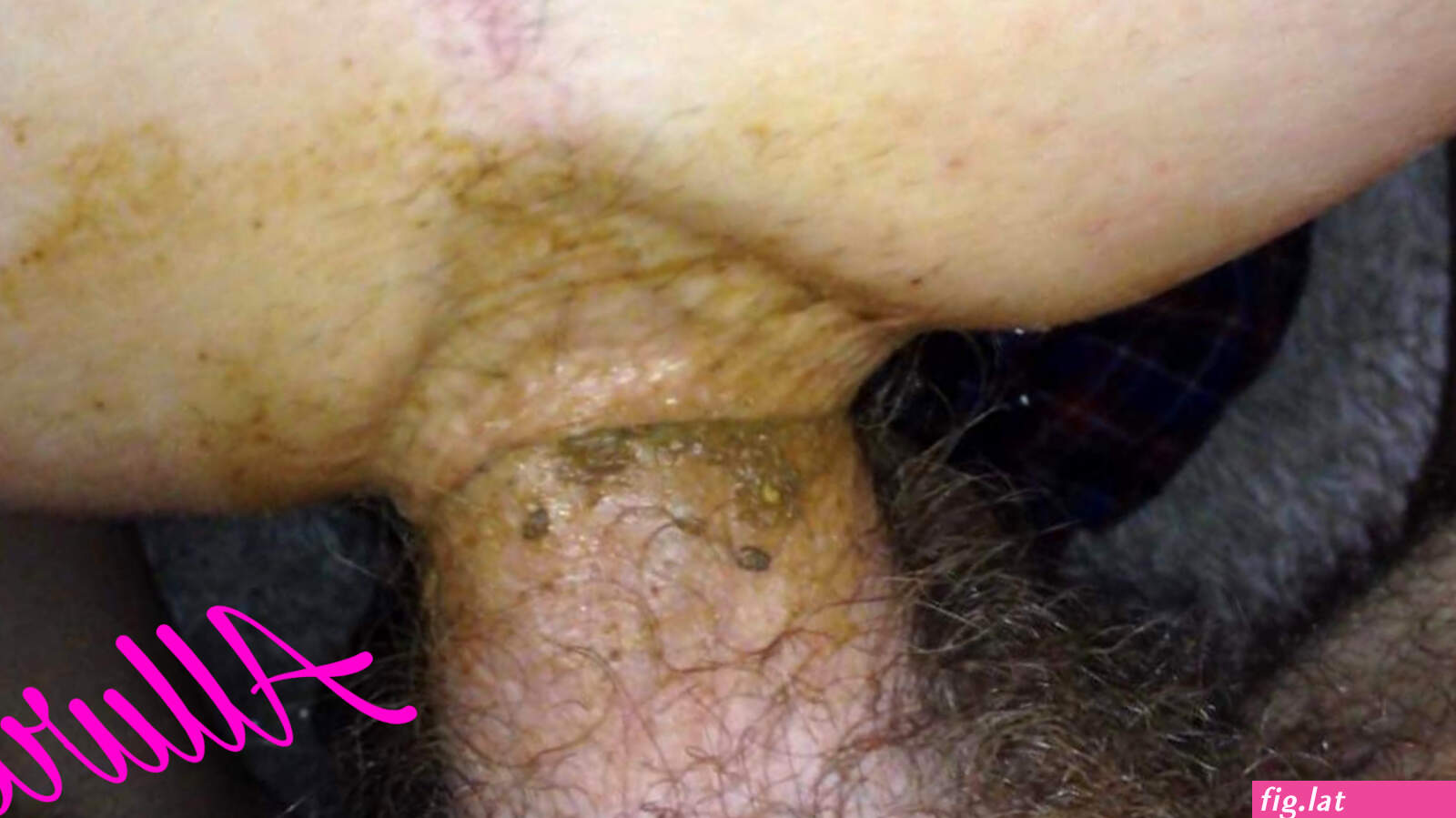 Durty anal (photos)
